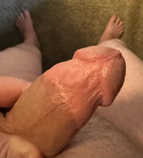 Had mine removed at 21