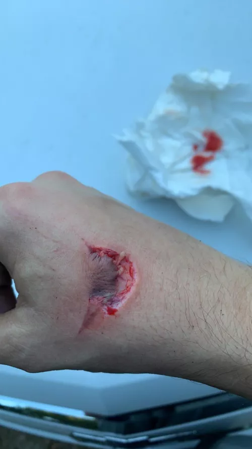 How long until I can use a shovel?