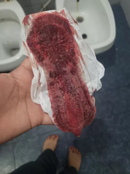 It's a good day right🩸