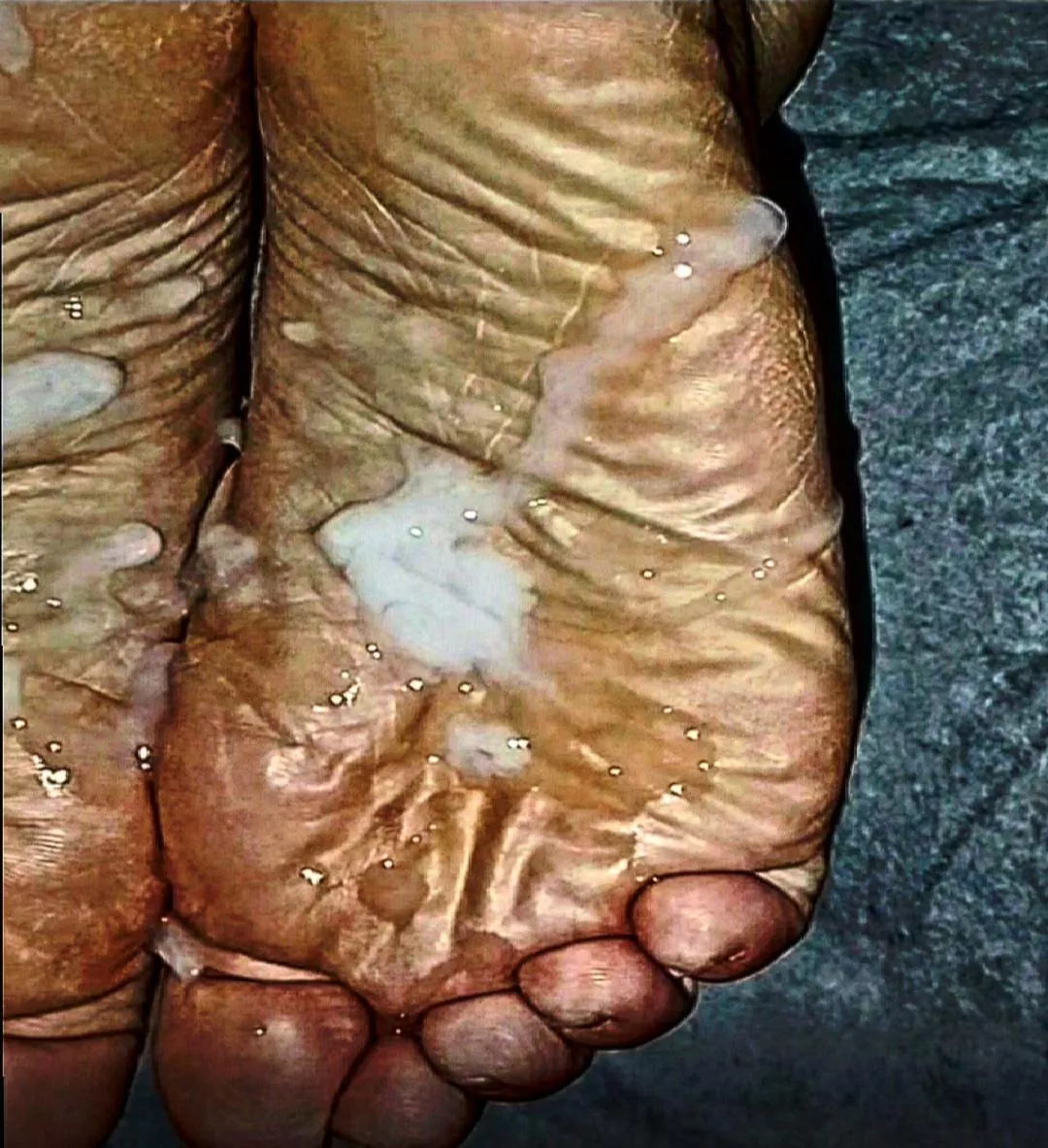 little lake on my soles