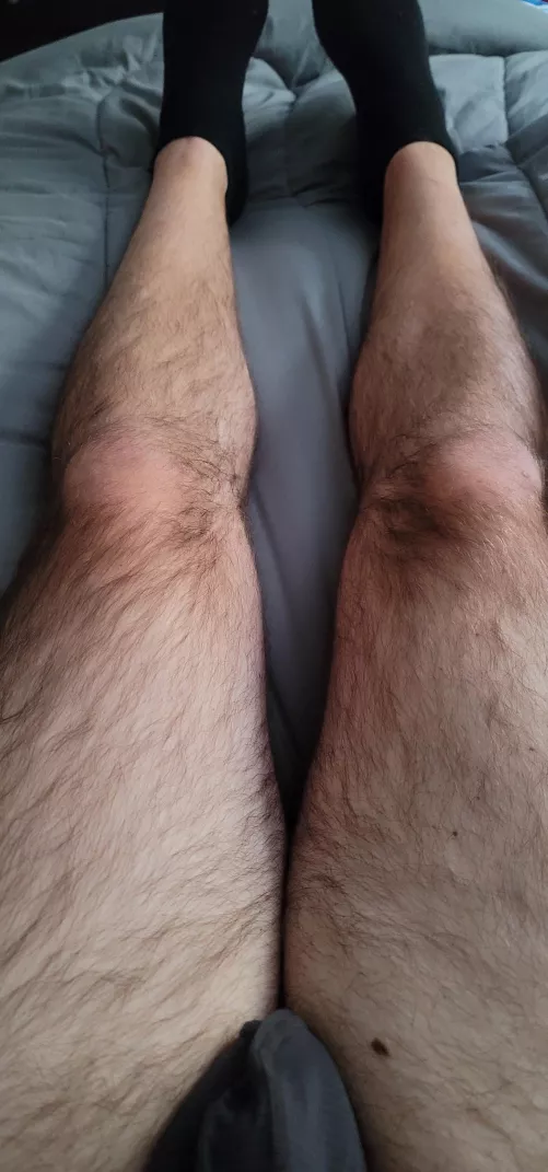 Long hairs? Thoughts? 