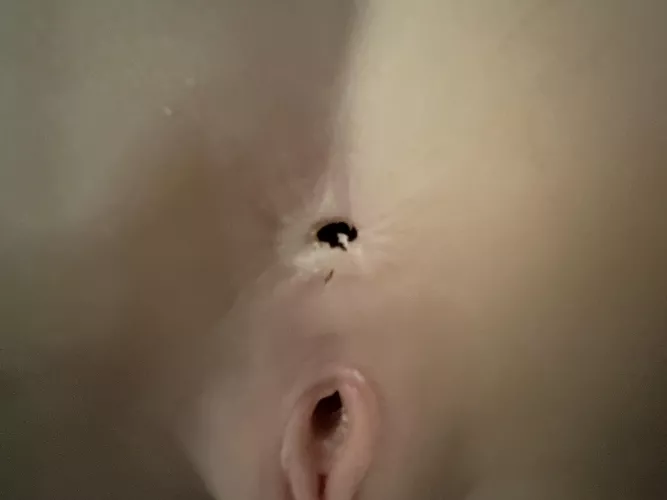 Minor repair question 