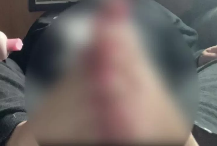 Moisturizing my toes 🫣🤭