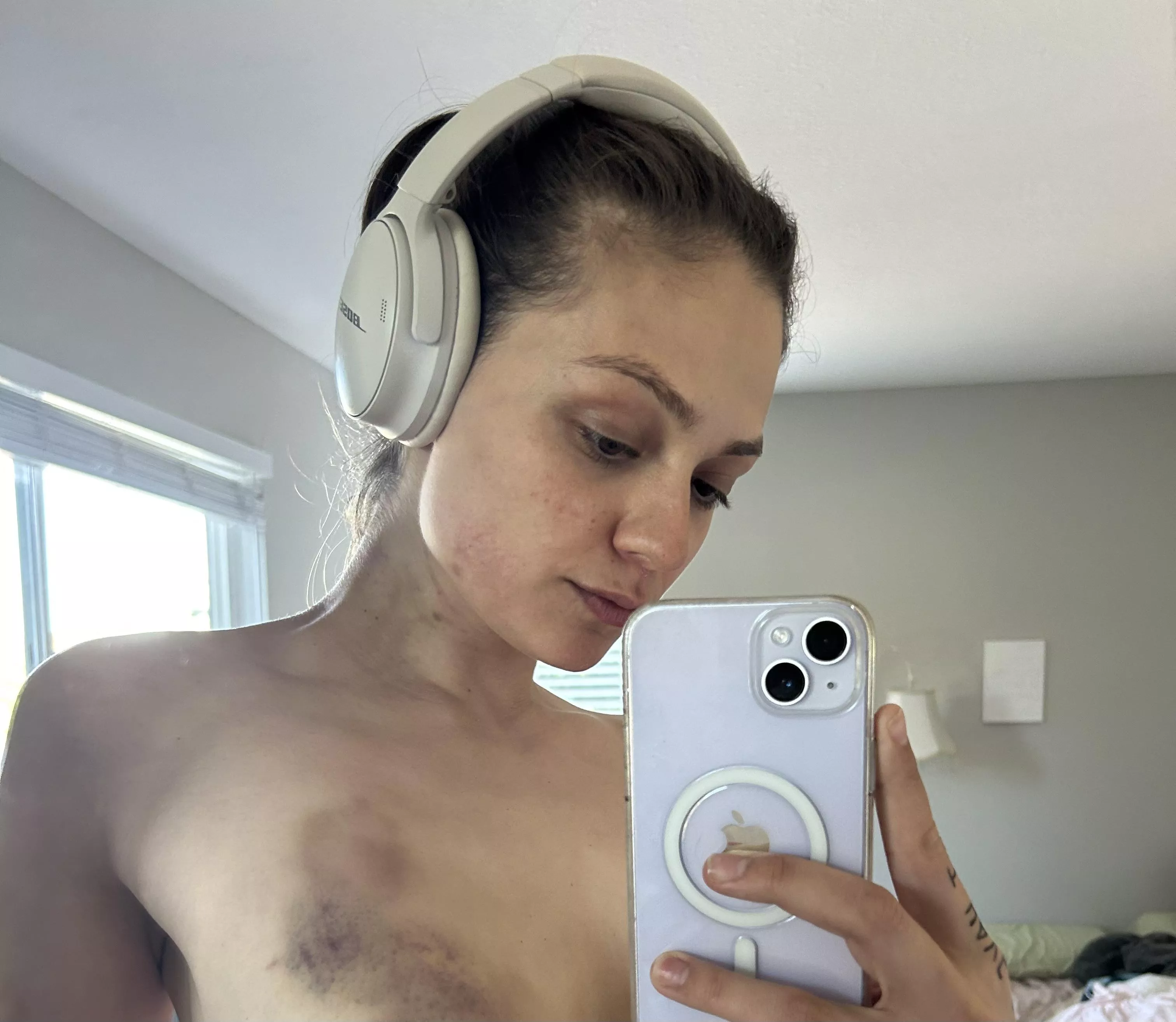 my bruises make me feel beautiful