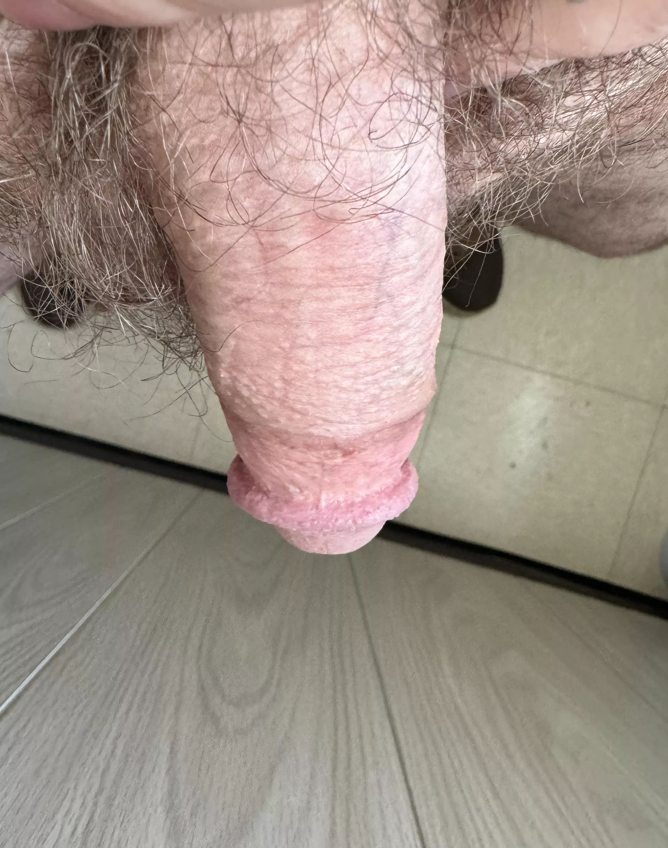 Needing help to relieve a little pressure 