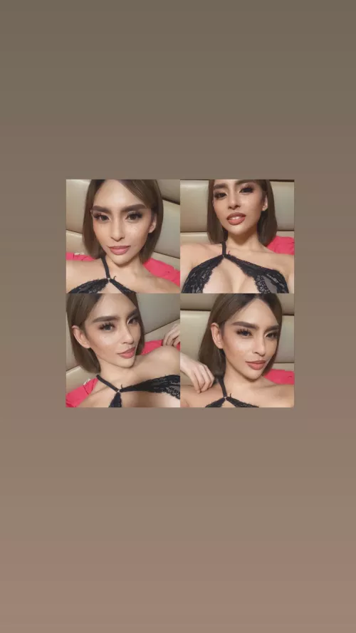 Pre Op Trans from QC. Available TODAY TODAY TODAY!