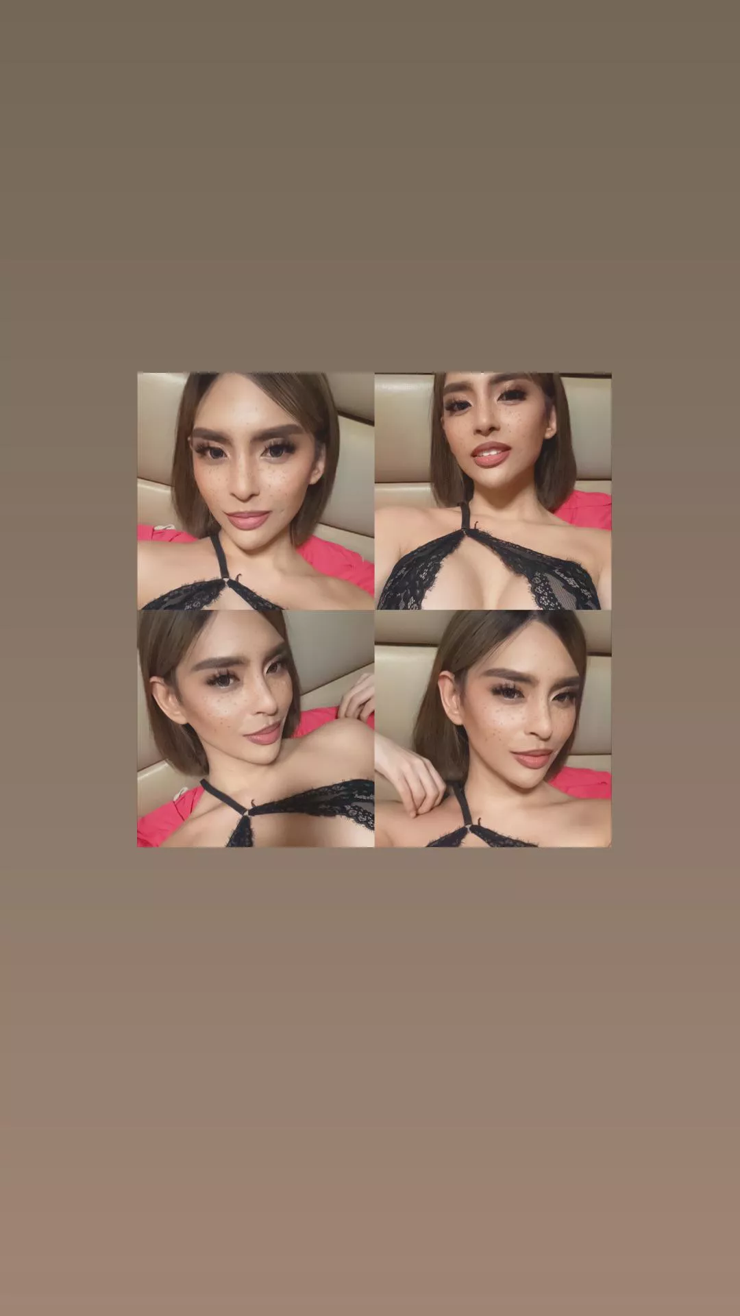 Pre Op Trans from QC. Available TODAY TODAY TODAY!