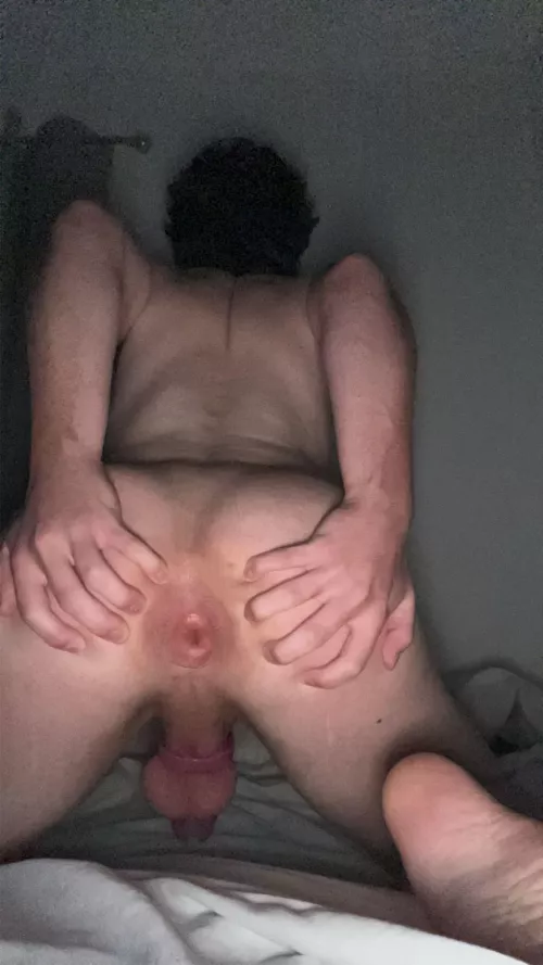 puckered up and always ready to be used [20]