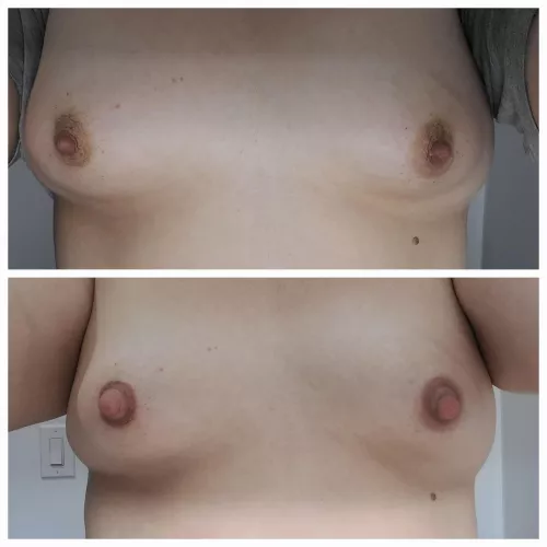 Pumping my tits daily so they're easier targets for abuse and always sore. 