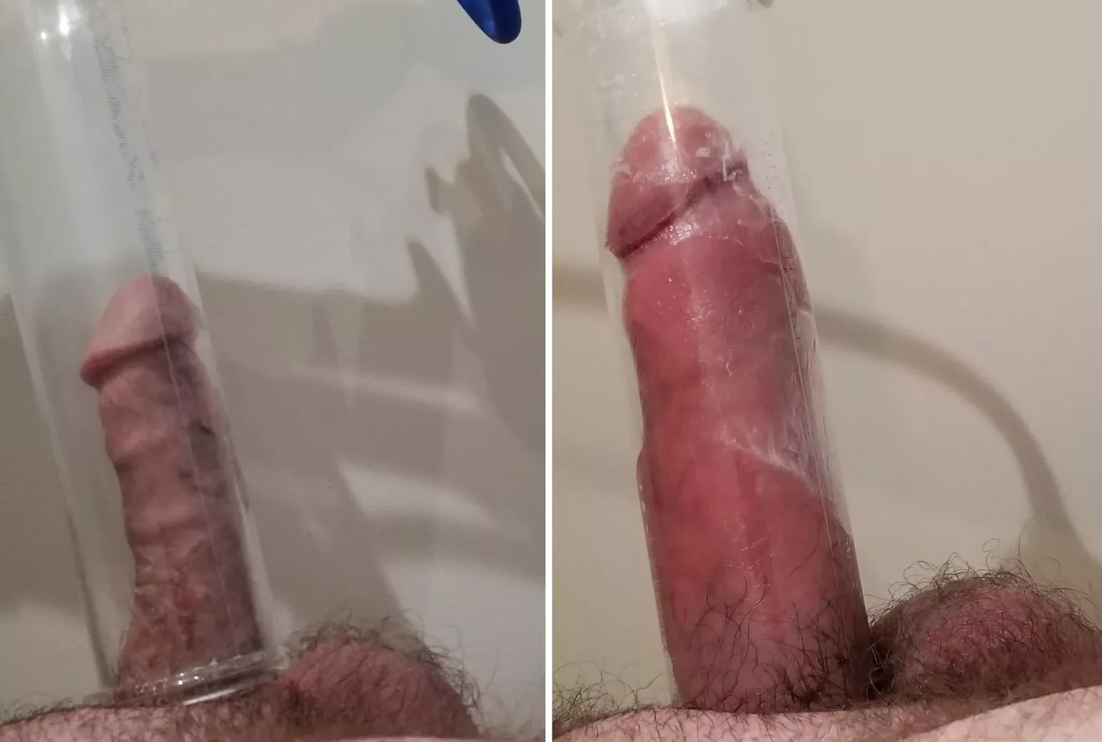 Quick before and after