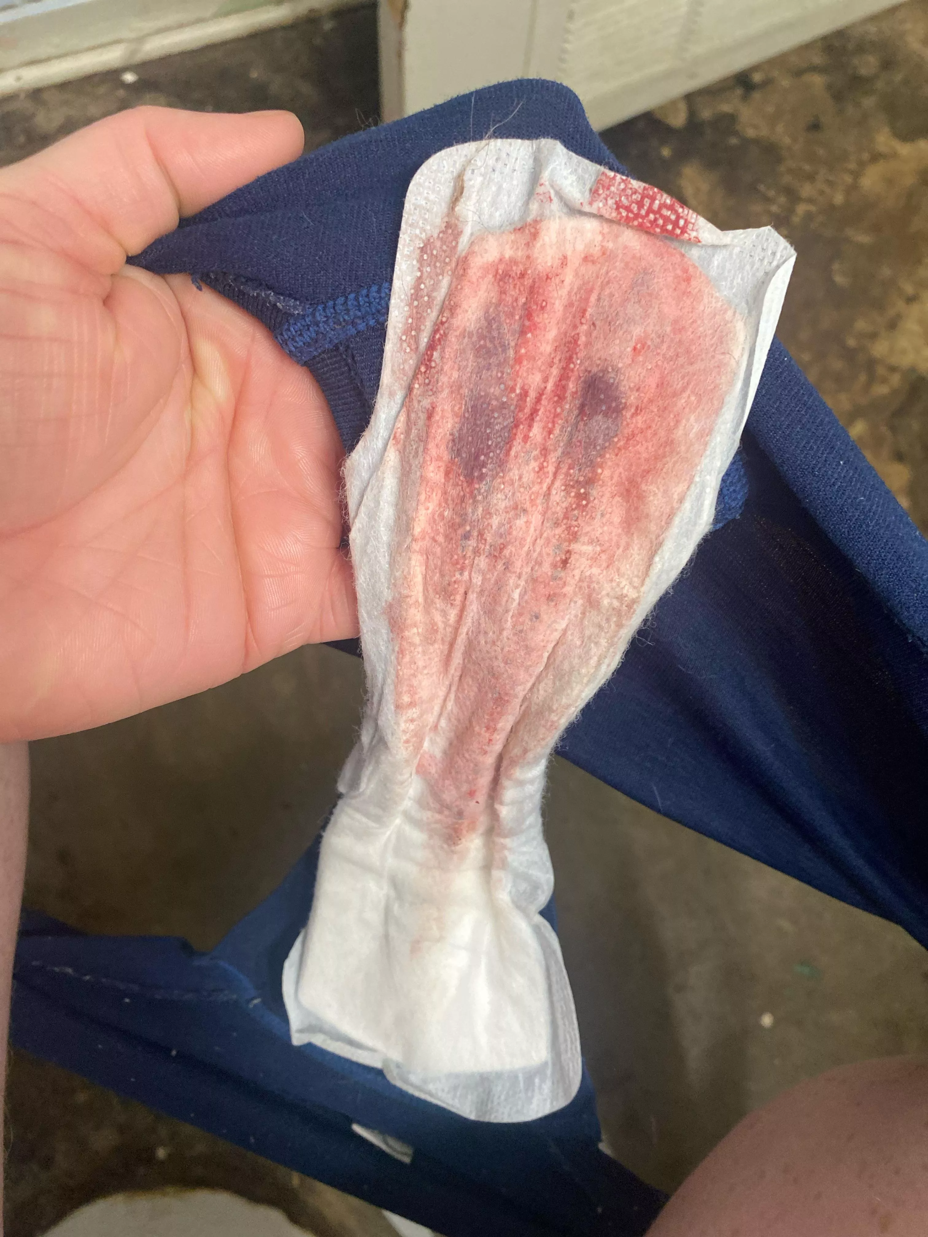 she’s so full !!🩸🩸