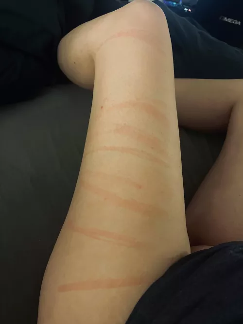 This isn’t the end of it…