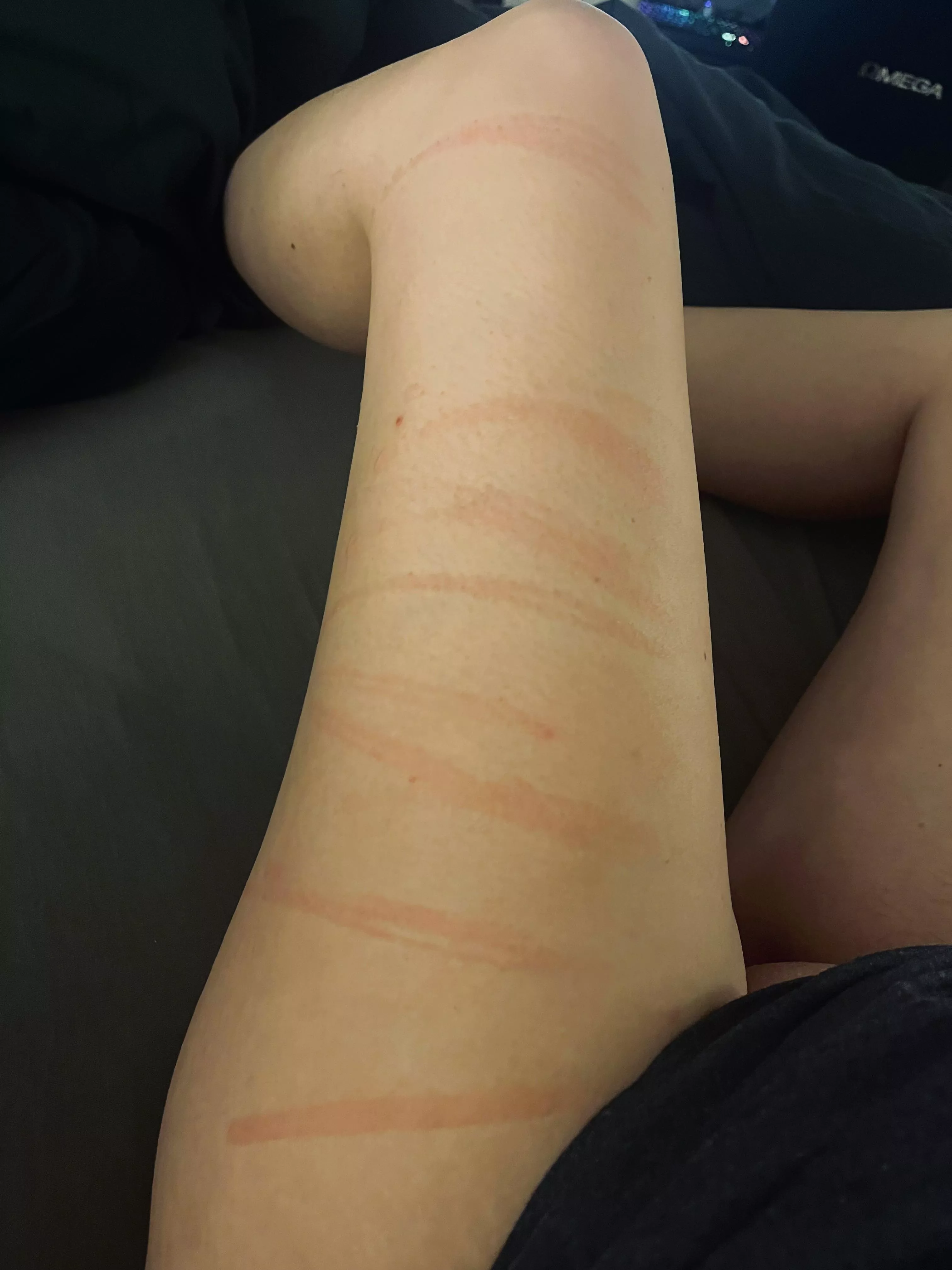 This isn’t the end of it…