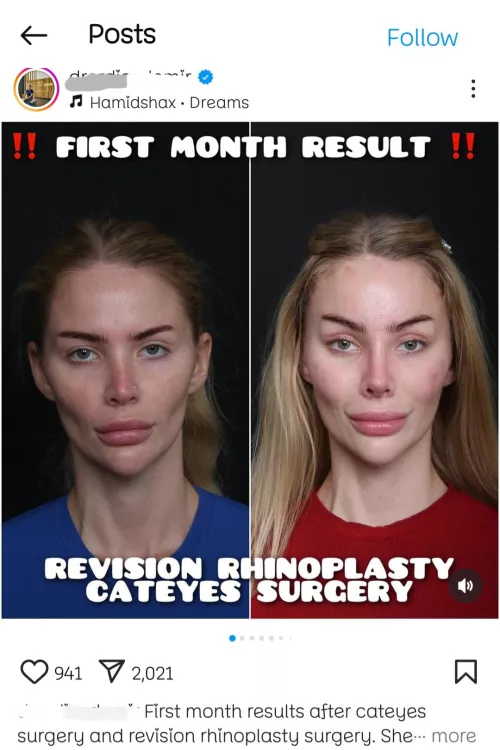 Was bad before, but the Dr was proud of his work in the 