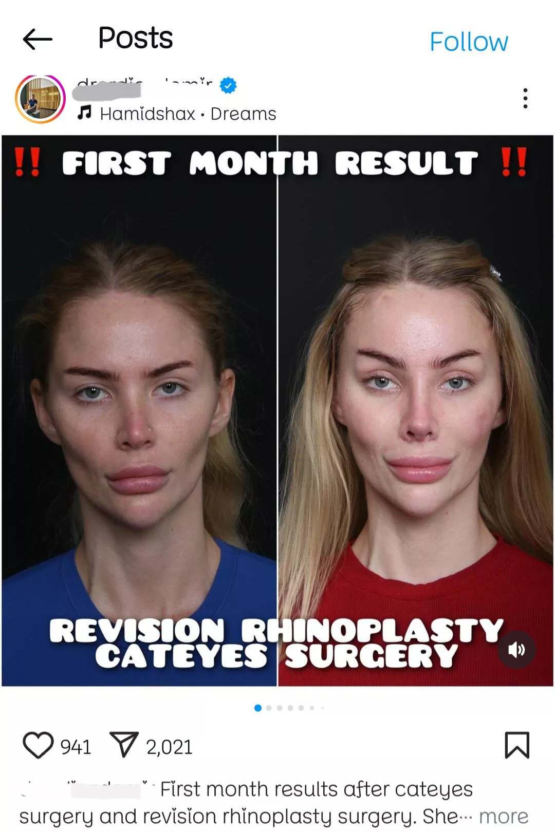 Was bad before, but the Dr was proud of his work in the 