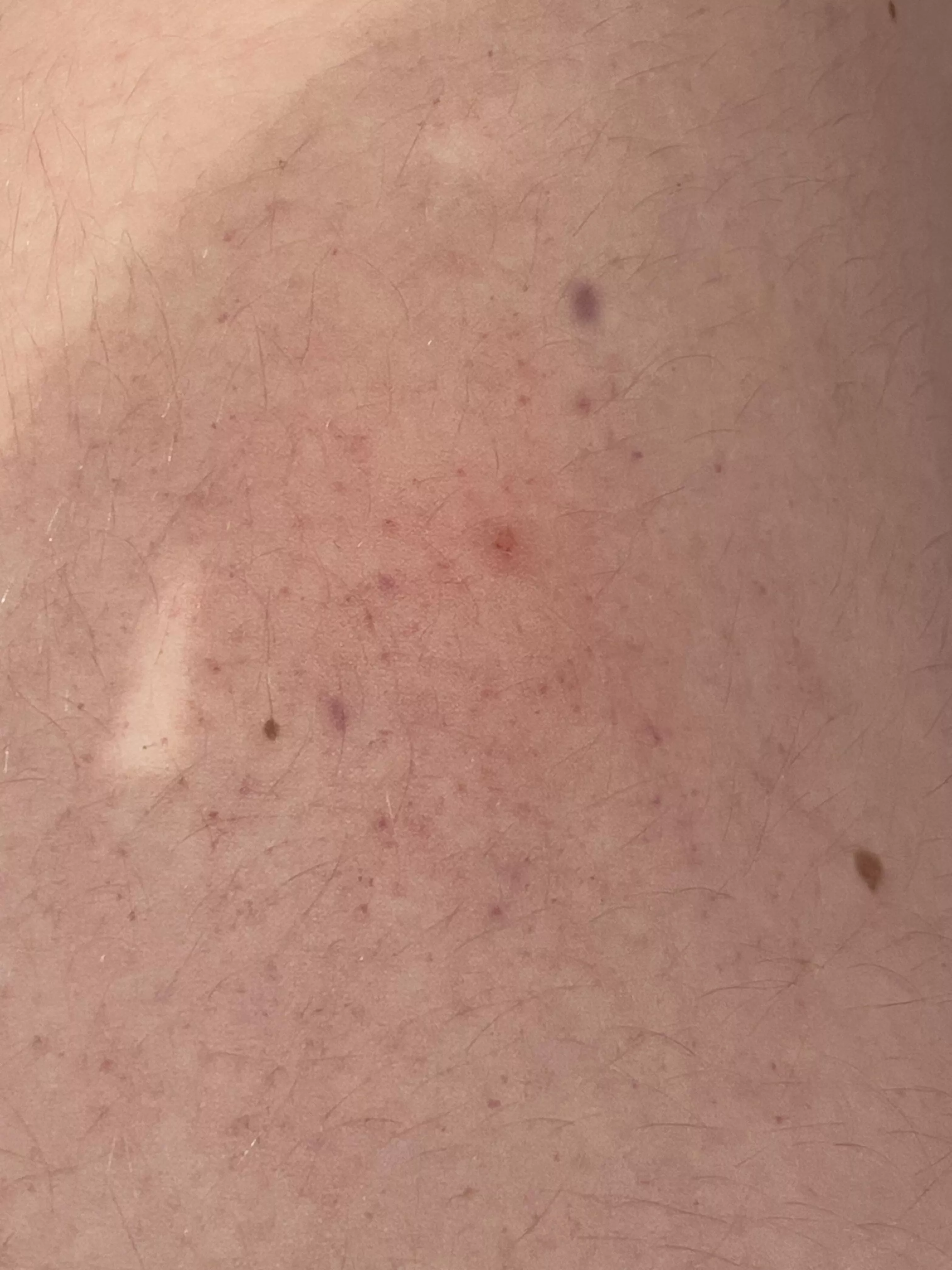 Weird spots appearing on me 