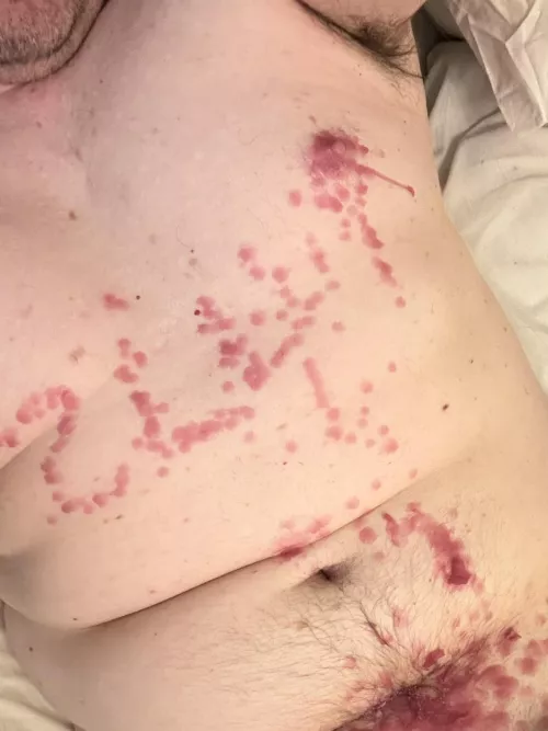 45m: need a lady to write on me properly. I can’t do it myself!