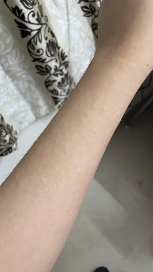 Any idea what’s happening to my skin?