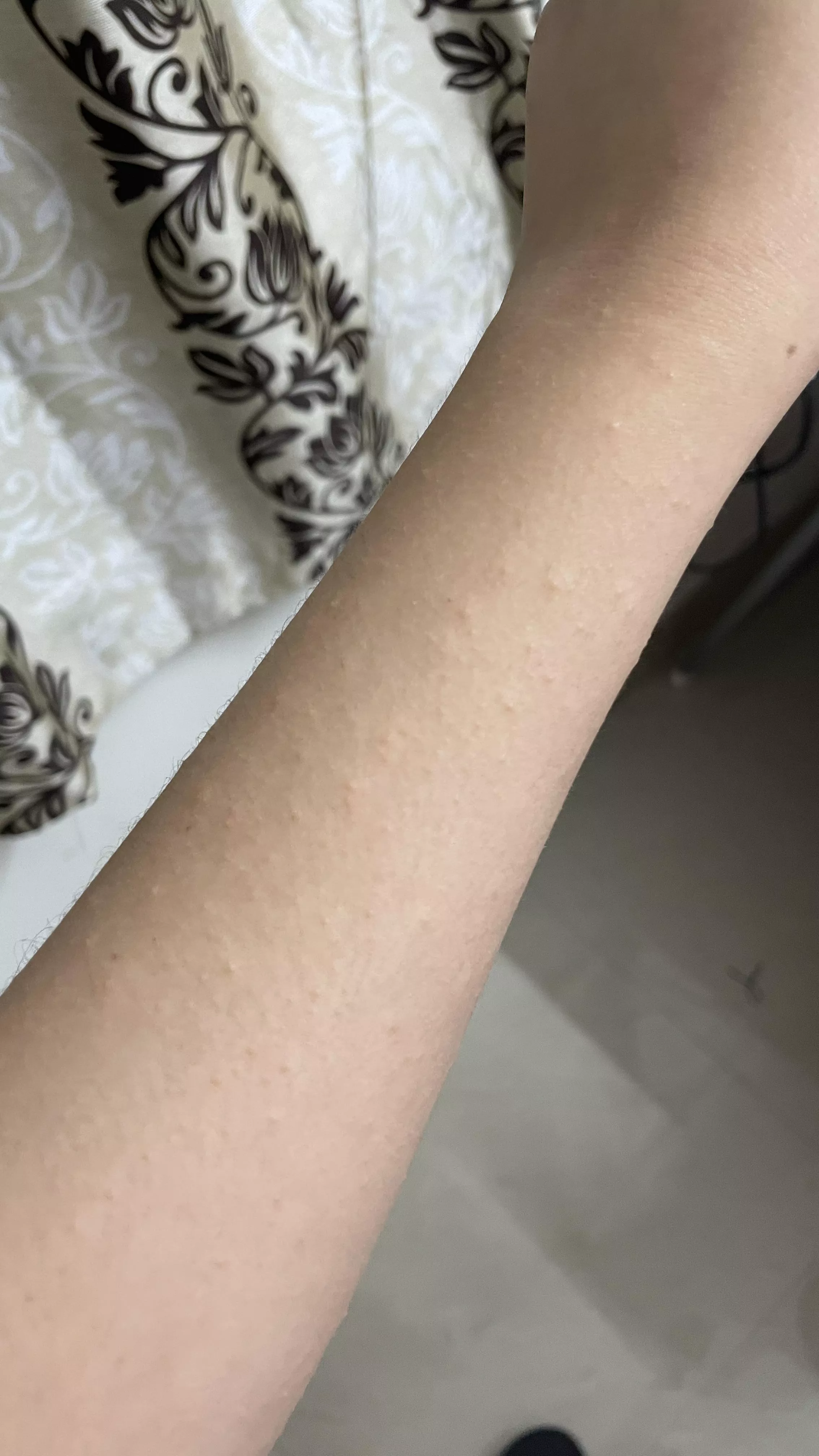 Any idea what’s happening to my skin?