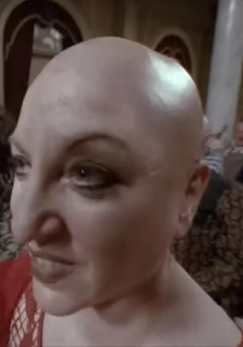 Bald and Sexy 