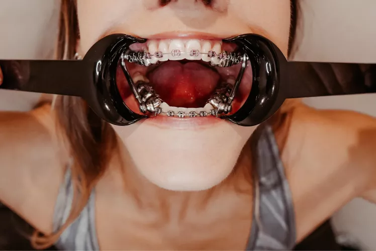 Can you fill this hole up please?