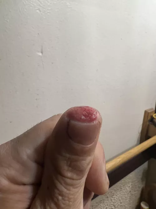 Chopped the tip of my thumb off