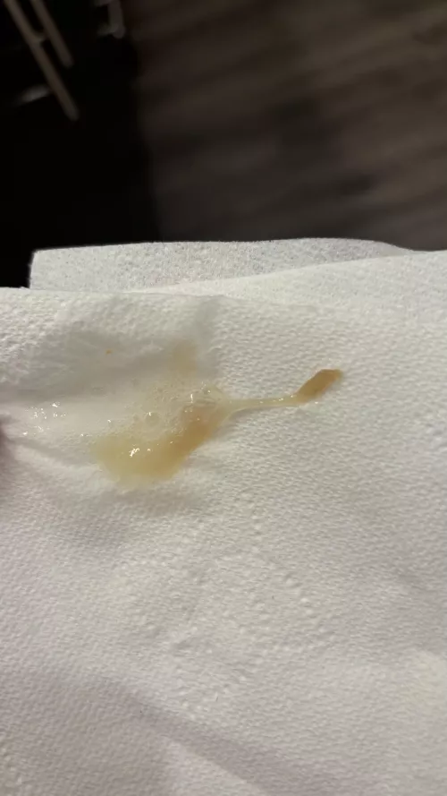 Does anyone know what this is? I’ve been harking this up for years?