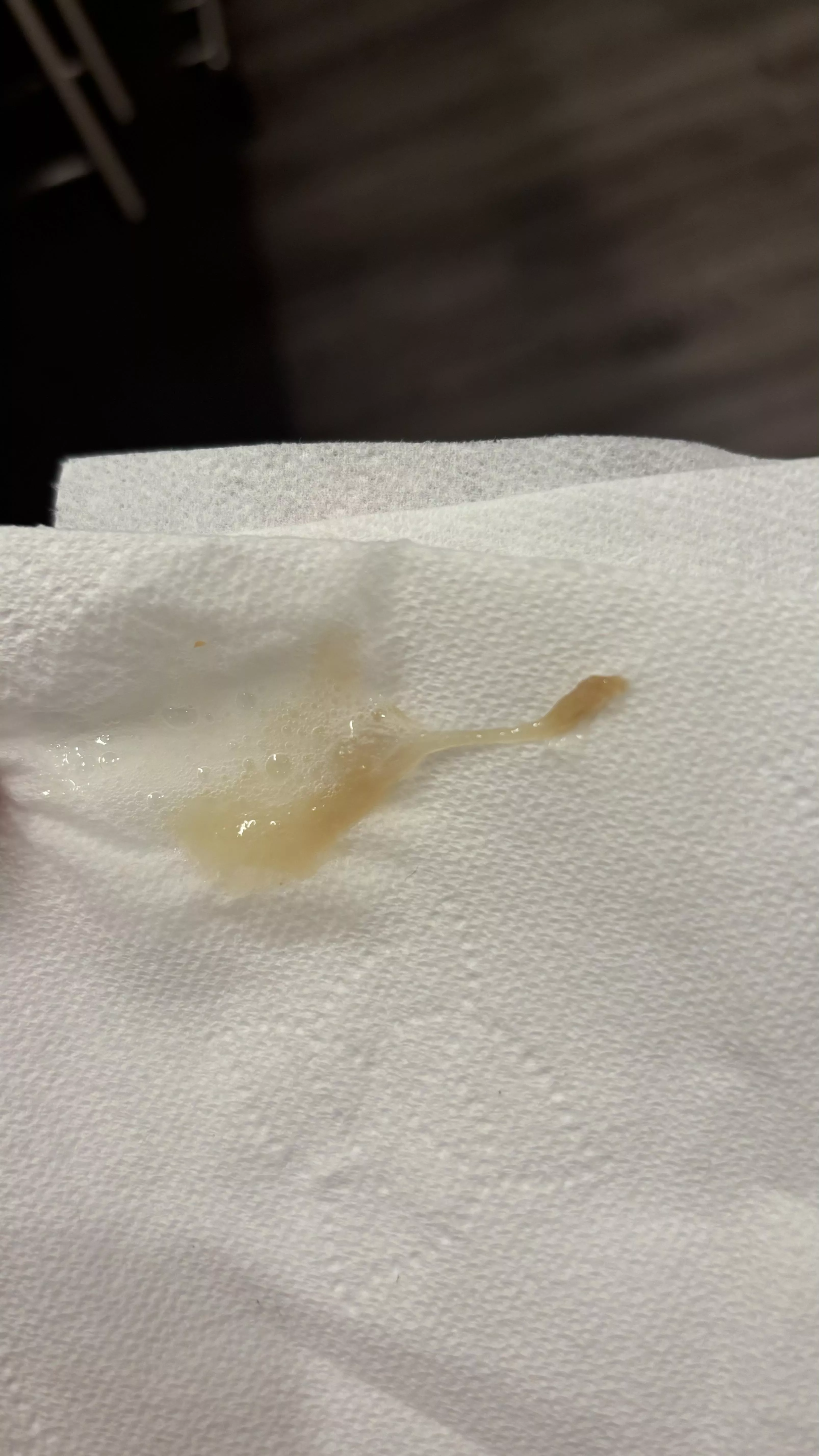 Does anyone know what this is? I’ve been harking this up for years?