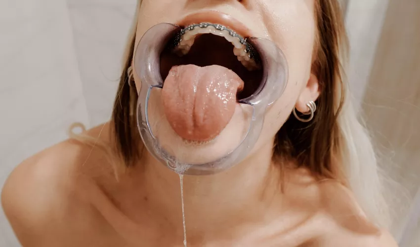 Help, I can’t stop drooling