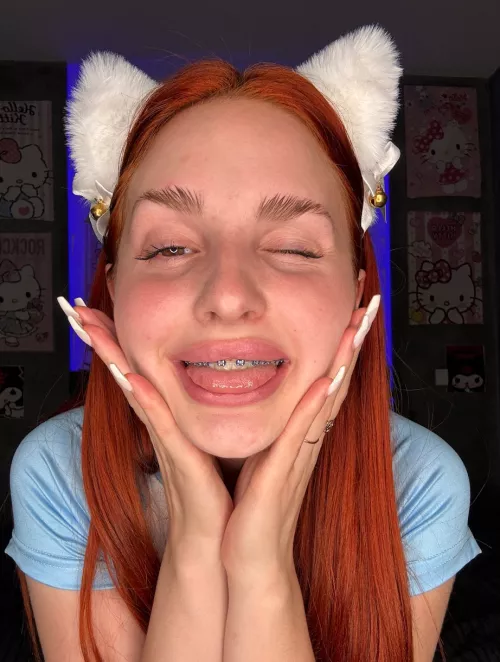 I bet you need a dose of young ginger? 