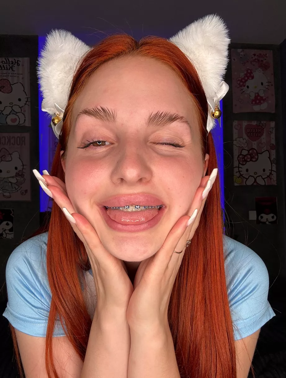 I bet you need a dose of young ginger? 