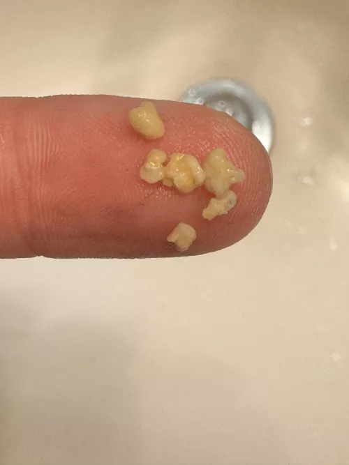 Just coughed these bad boys up 😄