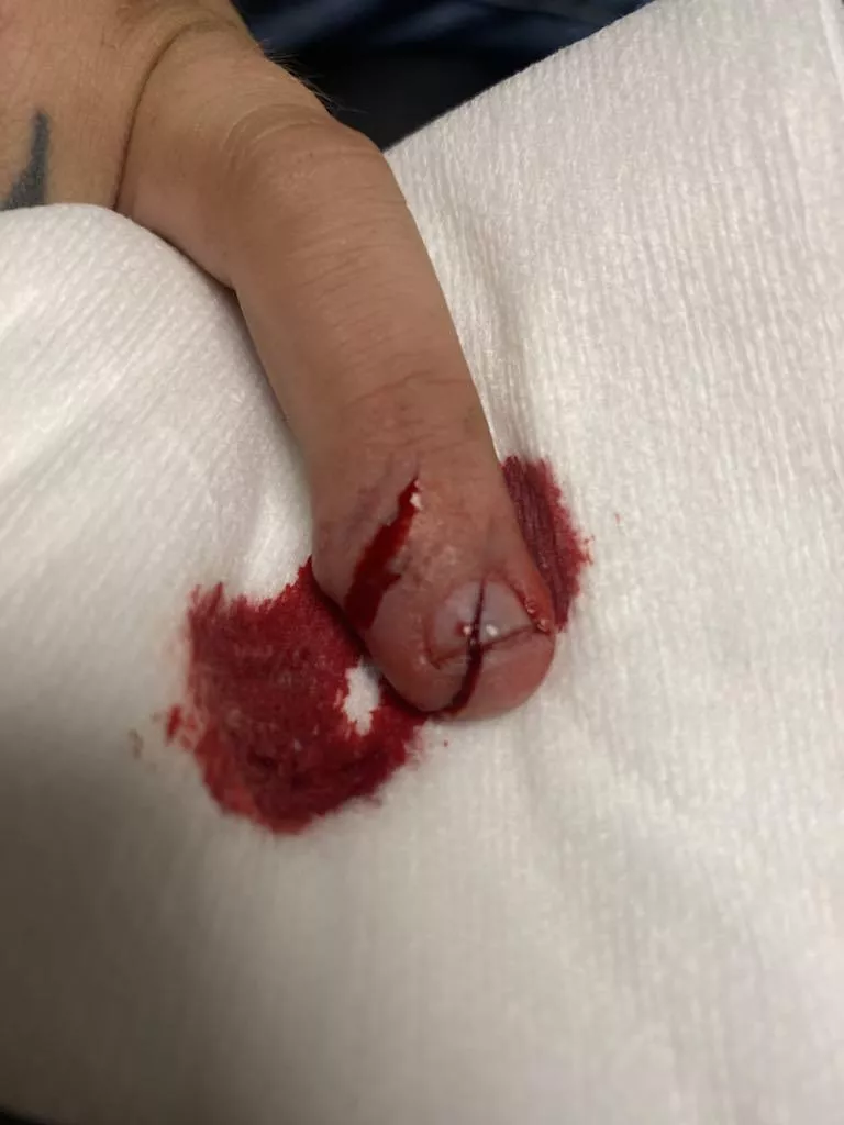 Lost to the hedge trimmers this morning