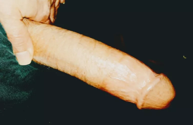 Need this taken care of. 