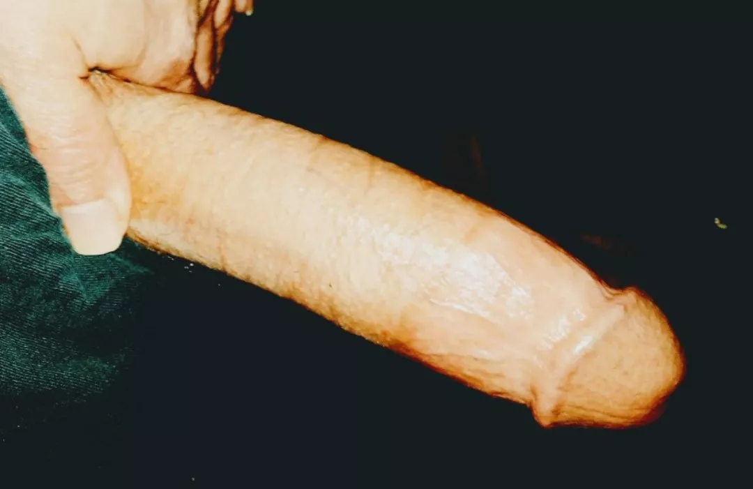 Need this taken care of. 