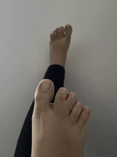 New here… Did you ever saw joined toes?