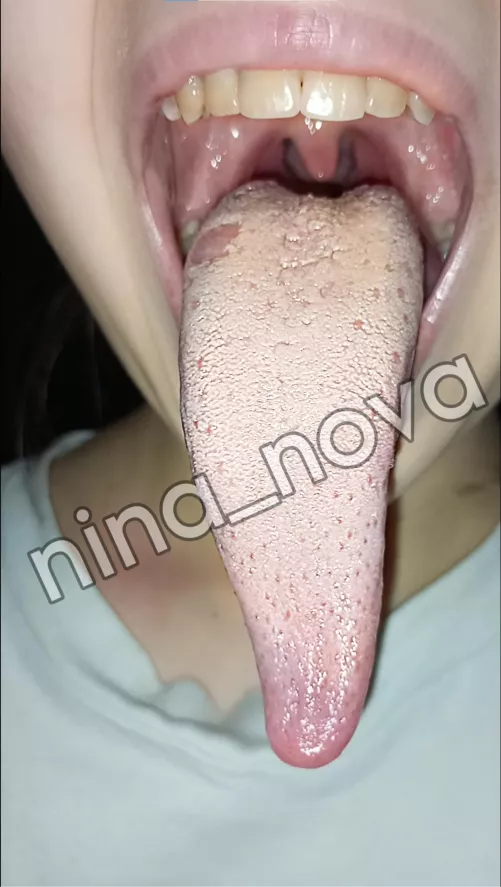 The longest tongue here 