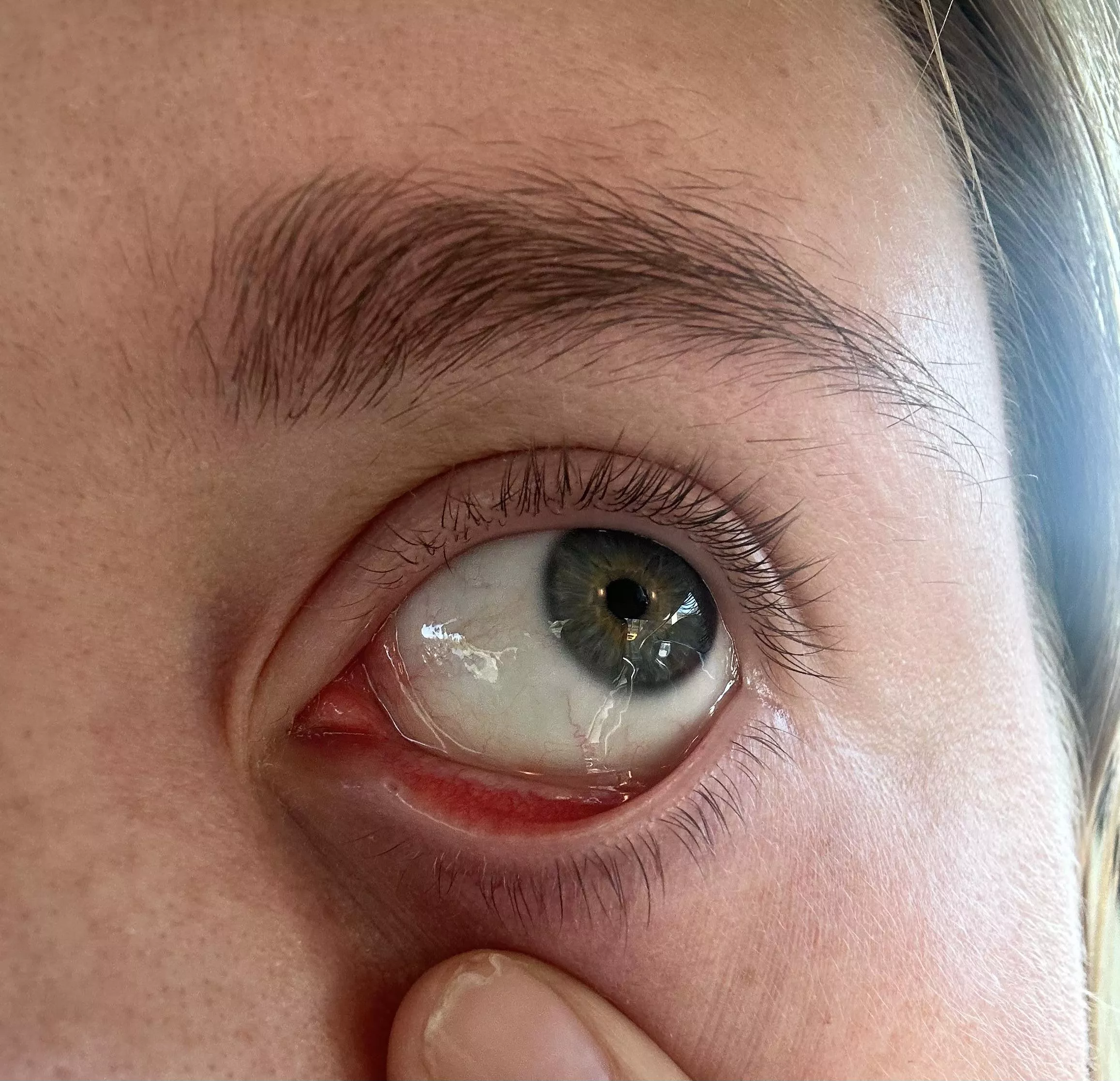 What is this inside the corner of my eyelid? 