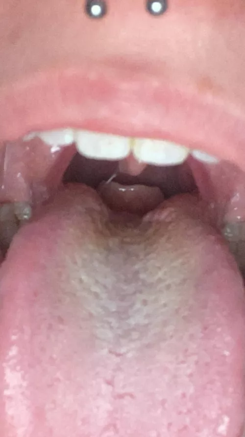 whata this at back of my throat 