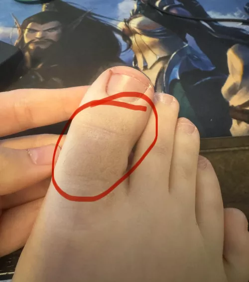 Why is my skin like this?