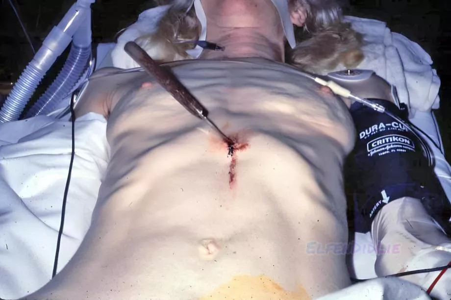 Woman stabbed in her abdomen