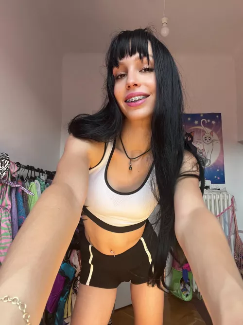 braces are super adorable