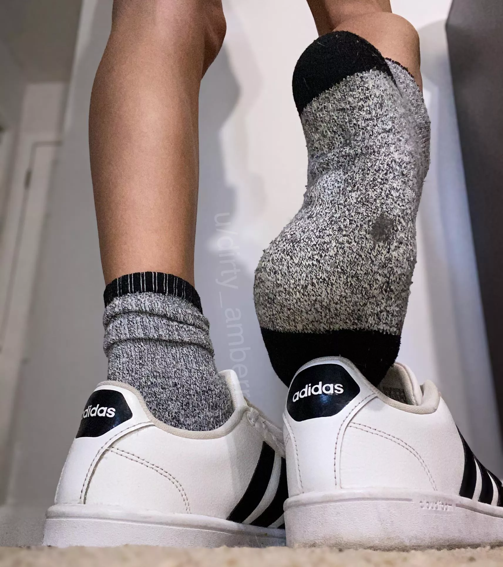 Can you remove them with your teeth