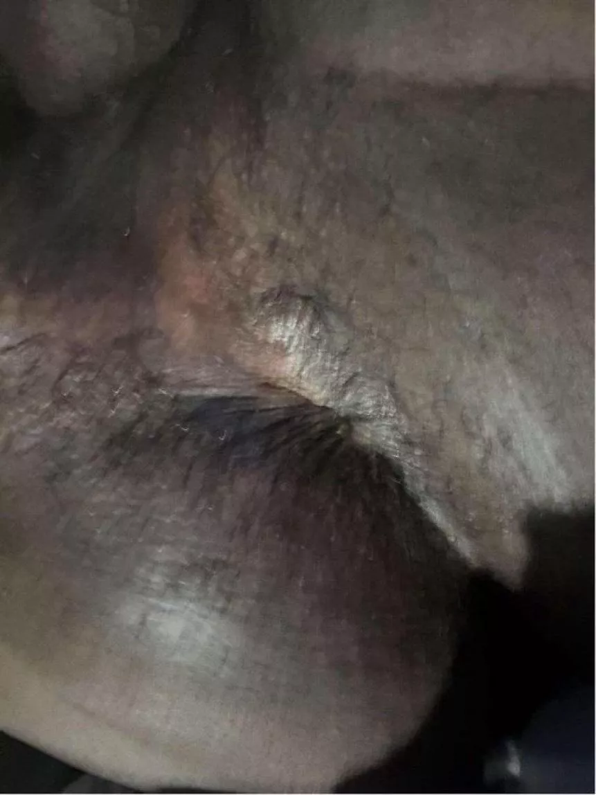 dm me if you wanna chat about how much youd be able to stretch this hole ;)