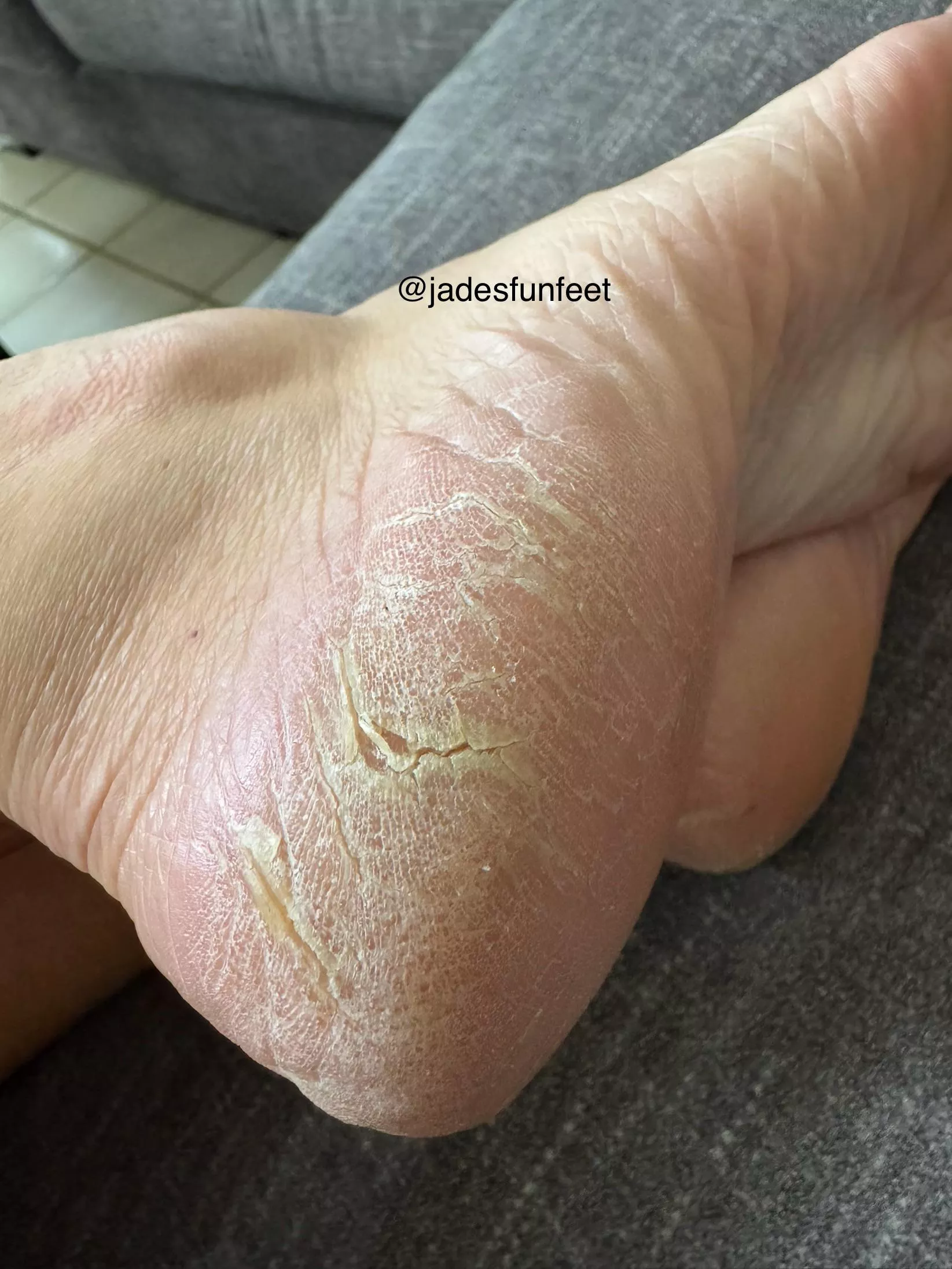 Dry Feet need love too