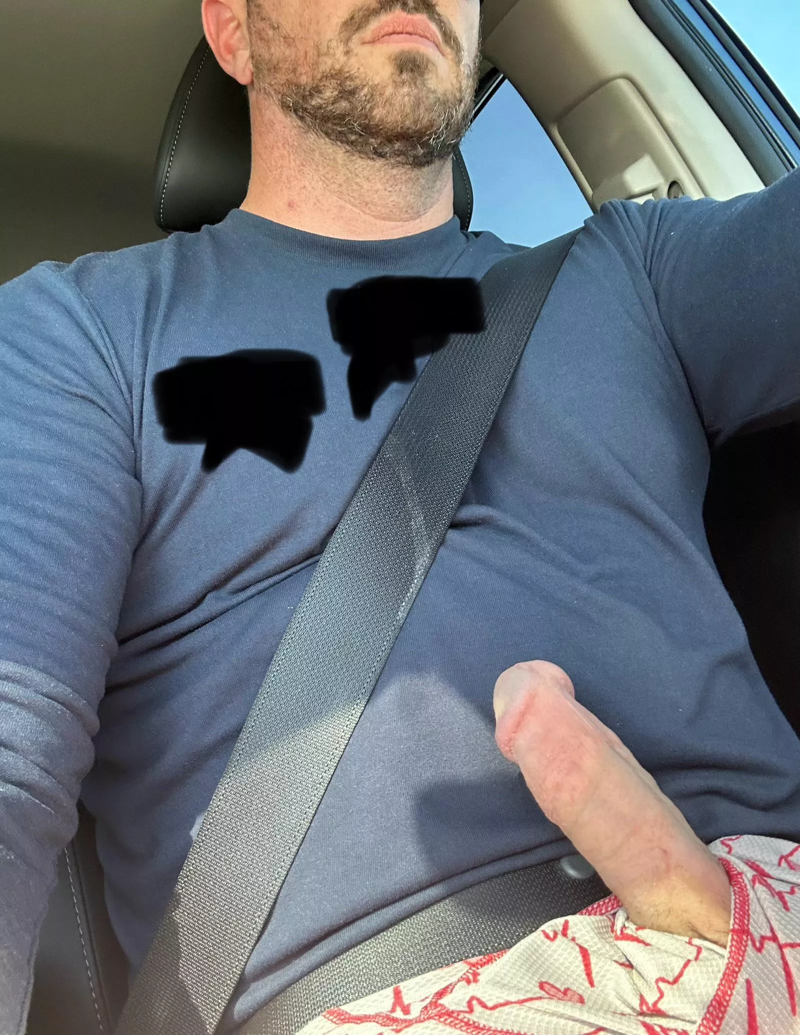 Hope this goes away before my chiropractor appointment, because I don’t think the gym shorts will conceal it…