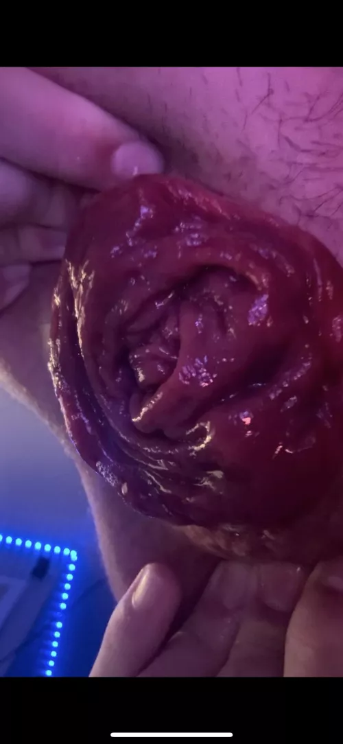 its finally falling out!