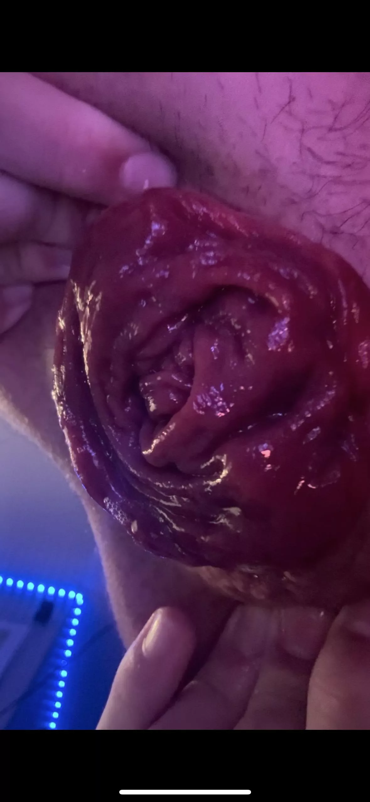 its finally falling out!