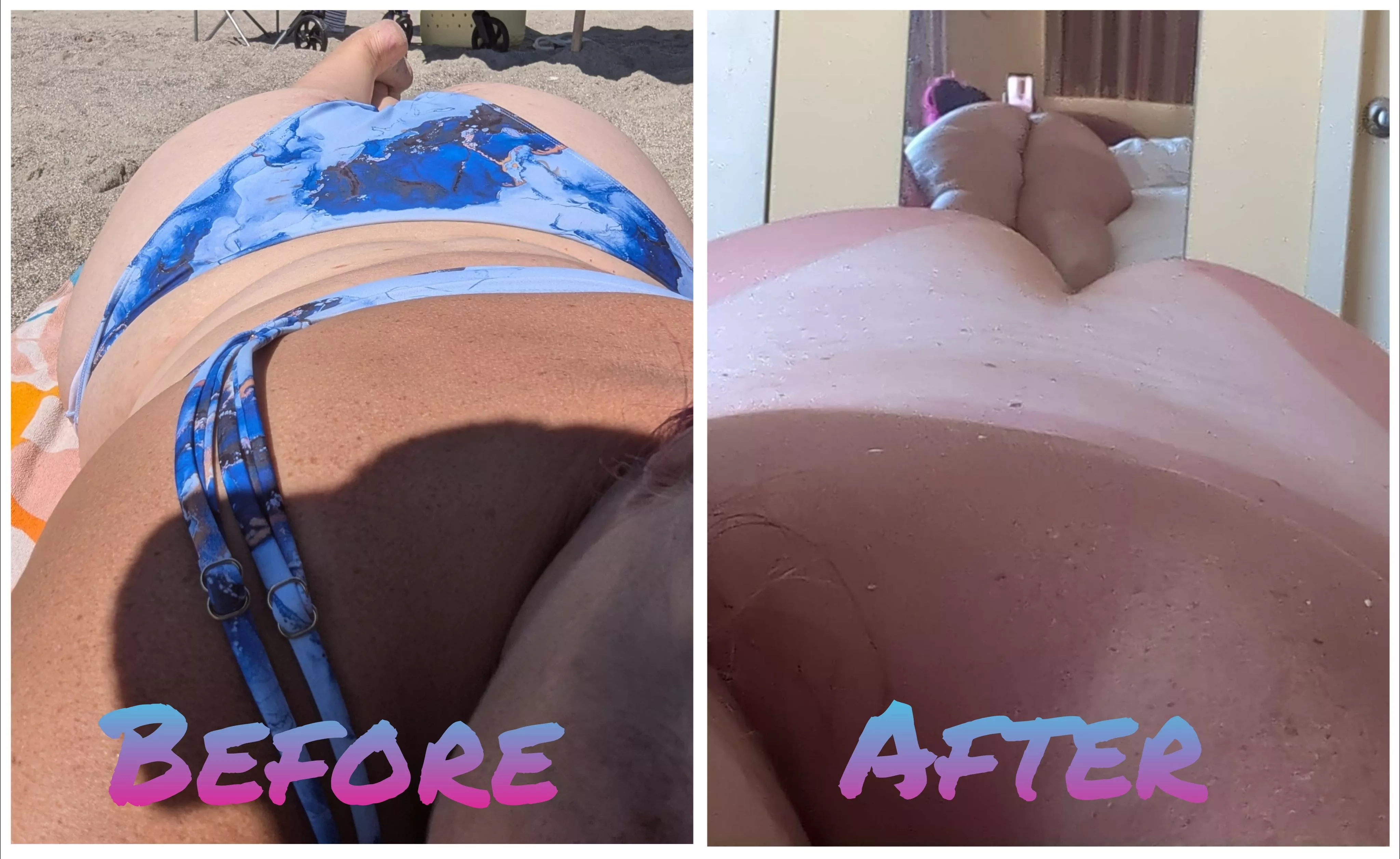 Love beach days! 🏖️👙🌊 But definitely gonna need someone to rub aloe on my cheeks! 🍑