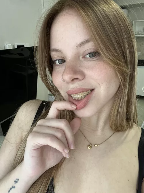 My braces make me attractive 